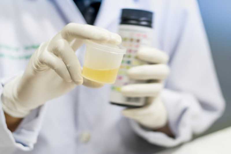 Exame de Sangue Toxicológico Agendar Vila São Geraldo - Exame Toxicológico para Habilitação