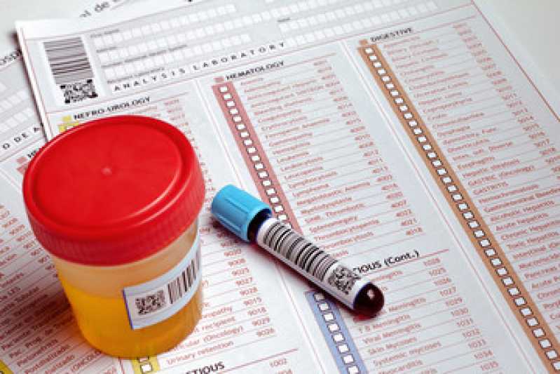 Exame de Sangue Toxicológico Guaianases - Exame de Sangue Toxicológico