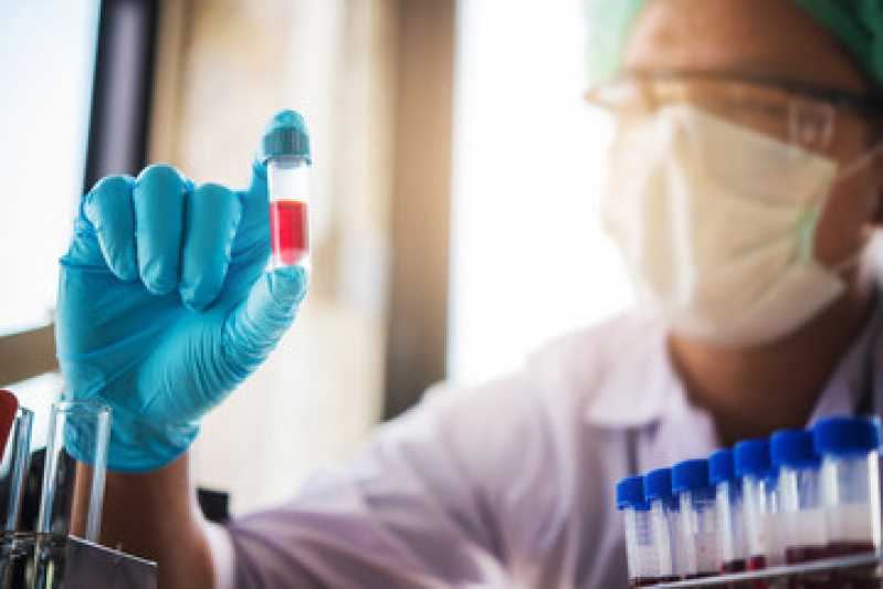 Exame Toxicológico de Sangue Vila Gomes Cardim - Exame Toxicológico para Habilitação