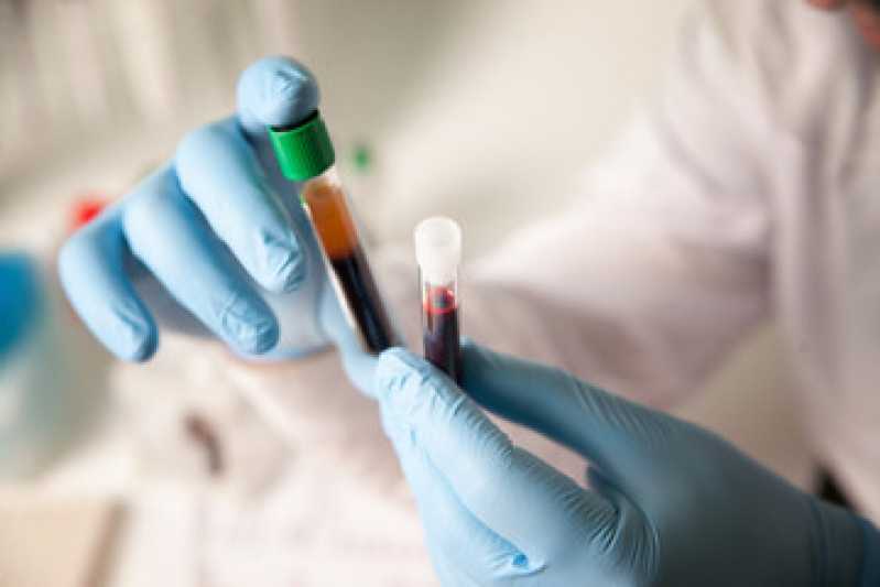 Onde Faz Exame Toxicológico Mais Próximo Tatuapé - Exame de Sangue Toxicológico